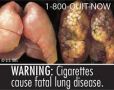 cigarette-disease